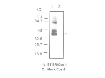 #16205 Anti-Human Endothelin-B (ET-B) Receptor (B27) Rabbit IgG Affinity Purify