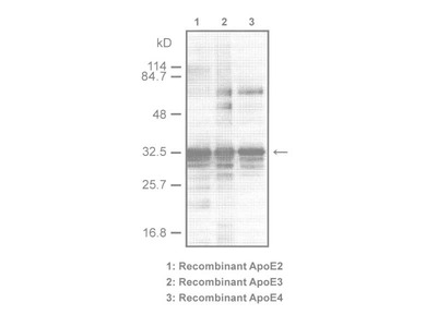 #18171 Anti-Human ApoE (A299) Rabbit IgG Affinity Purify