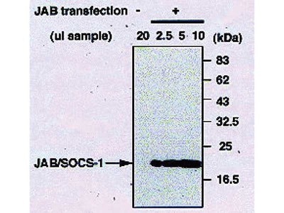 #18381 Anti-Human JAB/SOCS-1 (J192) Rabbit IgG Affinity Purify