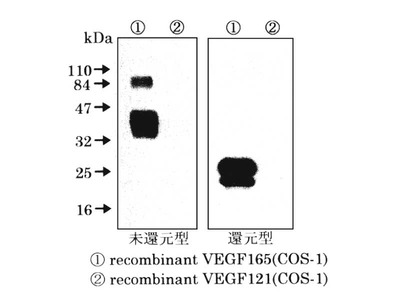 #18413 Anti-Human VEGF (V-3) Rabbit IgG Affinity Purify