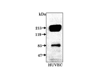 #18435 Anti-Human KDR (C) Rabbit IgG Affinity Purify