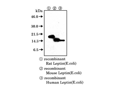 #18545 Anti-Human Leptin (C) Rabbit IgG Affinity Purify