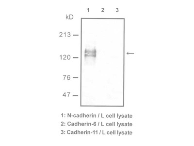 #18571 Anti-Human N-Cadherin (YS) Rabbit IgG Affinity Purify