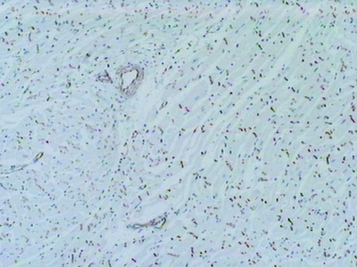 #18574 Anti-Human N-Cadherin (760) Rabbit IgG Affinity Purify