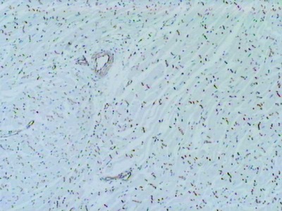 #18574 Anti-Human N-Cadherin (760) Rabbit IgG Affinity Purify