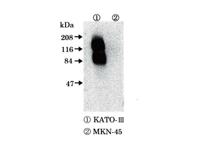 #18601 Anti-Human FGFR2/K-sam Rabbit IgG A.P.