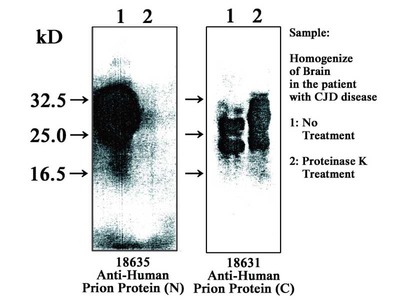 #18631 Anti-Human Prion Protein (C) Rabbit IgG Affinity Purify