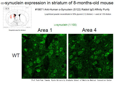 #18671 Anti-Human α-Synuclein (S122) Rabbit IgG Affinity Purify