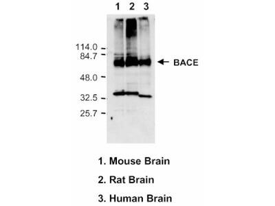 #18711 Anti-Human BACE1 (C) Rabbit IgG Affinity Purify