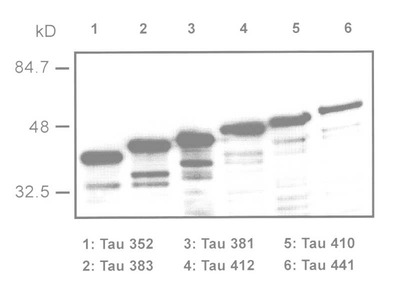 #18721 Anti-Human Tau Rabbit IgG Affinity Purify