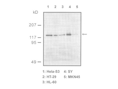 #18761 Anti-Human Sir2/SIRT1 Rabbit IgG Affinity Purify