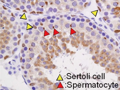 #18791 Anti- RET Finger Protein (RFP) Rabbit IgG Affinity Purify