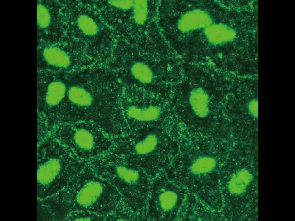 Porcine BBB endothelial cell