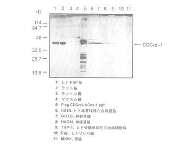 #18921 Anti-Human CDCrel-1 (C354) Rabbit IgG Affinity Purify