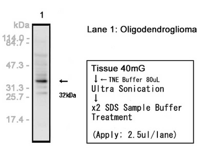 #18953 Anti-Human Olig2 Rabbit IgG Affinity Purify