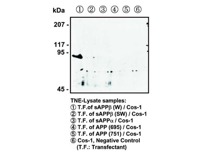#18957 Anti-Human sAPPβ-Wild Type Rabbit IgG Affinity Purify