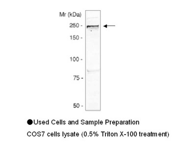 #18979 Anti-Human Girdin Rabbit IgG Affinity Purify