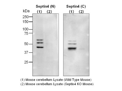 #18987 Anti-Human Septin 4 (N) Rabbit IgG Affinity Purify