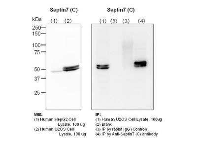 #18991 Anti-Human Septin 7 (C) Rabbit IgG Affinity Purify