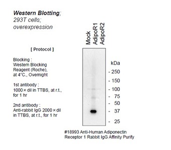 #18993 Anti-Human Adiponectin Receptor 1 Rabbit IgG Affinity Purify