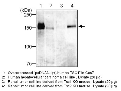 #28017 Anti-Human TSC1/Hamartin (T1149) Rabbit IgG Affinity Purify