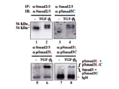 #28029 Anti- Smad3L (Ser 208/213 Phosphorylated) Rabbit IgG Affinity Purify