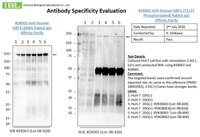 #28065 Anti-Human GBF1 (T1337 Phosphorylated) Rabbit IgG Affinity Purify