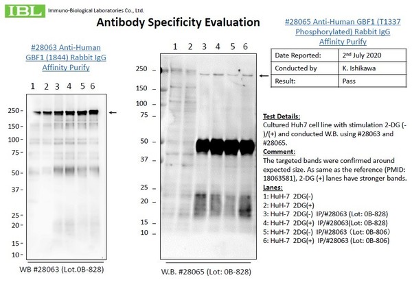 28065 Anti-Human GBF1 (T1337 Phosphorylated) Rabbit IgG Affinity 