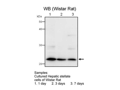 #28075 Anti-Mouse LRAT (Lecithin Retinol Acyltransferase) (168) Rabbit IgG Affinity Purify