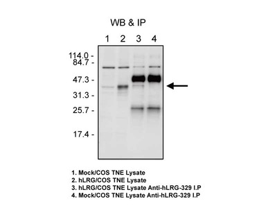 #28085 Anti-Human LRG (329) Rabbit IgG Affinity Purify