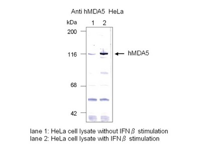 #29020 Anti-Human   MDA5 IgG Affinity Purify