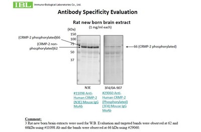 #29060 Anti-Human CRMP-2 (Phosphorylated) (3F4) Mouse IgG MoAb