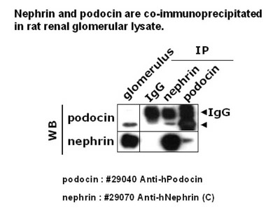 #29070 Anti-Human Nephrin (C) Rabbit IgG Affinity Purify