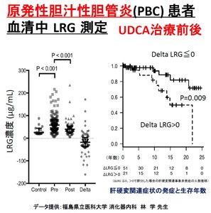 #27769 Human LRG Assay Kit - IBL【原材料在庫無くなり次第終了】