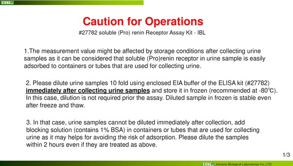 27782 sPRR_human_urine_sample_caution for operations