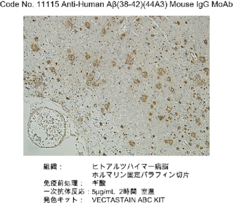 #11115 Anti-Human Amyloidβ (38-42) (44A3) Mouse IgG MoAb