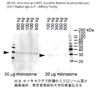 #28153  Anti-Human LRAT (Lecithin Retinol Acyltransferase) (031) Rabbit IgG A.P.