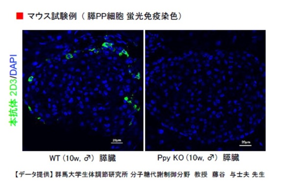 膵PP細胞 蛍光免疫染色