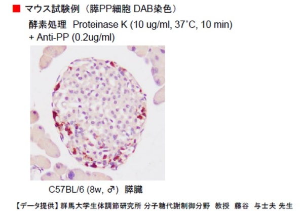 膵PP細胞 DAB染色