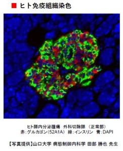 #10505 Anti-Glucagon (52A1A) Rat IgG MoAb