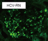 Anti-IgA_HCV-RN