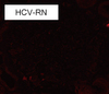 KM55_HCV-RN