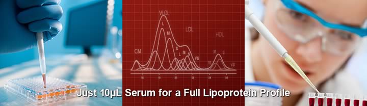 Lipid Profiling and Analyzing Service